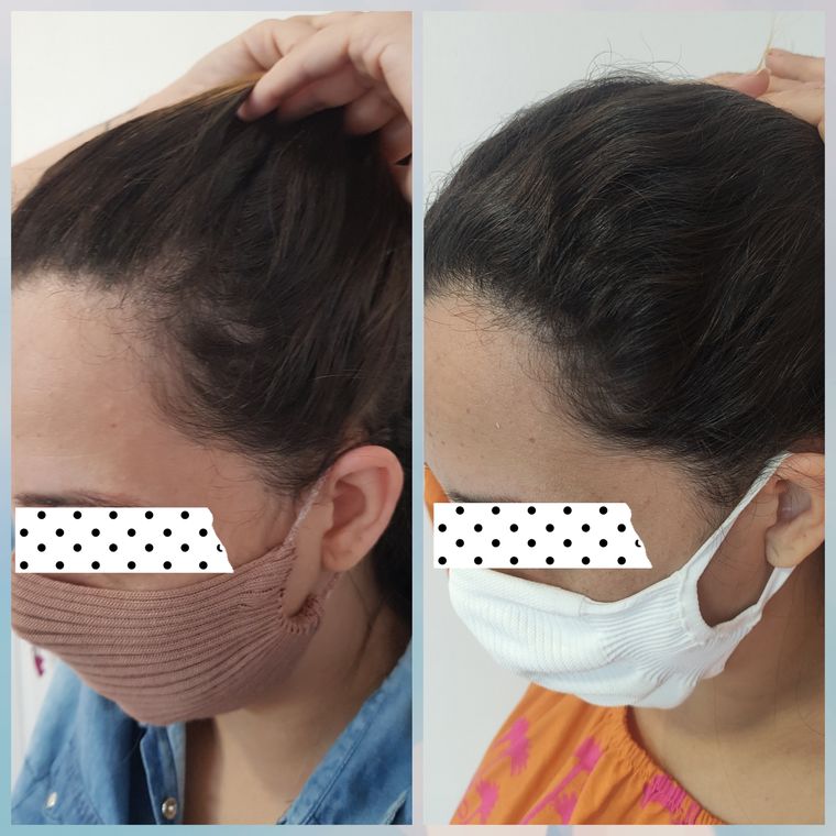 Resultado antes e depois de tratamento capilar 19